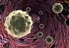 JAK2 Mutation, Leukocytosis Are Predictive Factors of Thrombosis in Essential Thrombocythemia JAK2 Mutation, Leukocytosis Are Predictive Factors of Thrombosis in Essential Thrombocythemia
