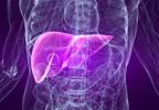 Addition of SIRT Fails to Improve Overall Progression-free Survival in Colorectal Cancer Liver Metastases Addition of SIRT Fails to Improve Overall Progression-free Survival in Colorectal Cancer Liver Metastases