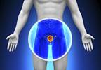 Hormone Therapy for Prostate Cancer (Fact Sheet) Hormone Therapy for Prostate Cancer (Fact Sheet)