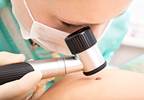 Computer 'Deep Learning' Algorithm Matches Dermatologists at Classifying Melanomas Computer 'Deep Learning' Algorithm Matches Dermatologists at Classifying Melanomas