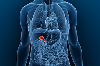 Is gallbladder cancer inherited? - ONA