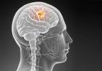 Wireless phone may increase risk of gliomas Wireless phone may increase risk of gliomas