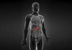 Onset or Rapid Worsening of Diabetes May Indicate Pancreatic Cancer Onset or Rapid Worsening of Diabetes May Indicate Pancreatic Cancer