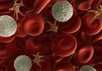 New myeloma treatment options promising New myeloma treatment options promising