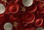 Data Confirm Auto-HCT as Standard Approach for Myeloma in Young Patients Data Confirm Auto-HCT as Standard Approach for Myeloma in Young Patients