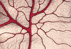Managing venous irritation from fosaprepitant Managing venous irritation from fosaprepitant