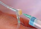 Reconstituting nab-paclitaxel Reconstituting nab-paclitaxel
