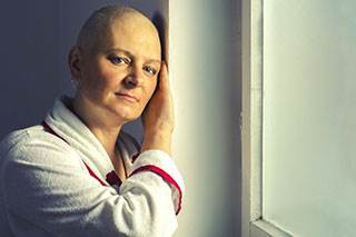 Alopecia is a common side effect of chemotherapy. Alopecia is a common side effect of chemotherapy.