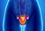 Hospice increase doesn't offset end-of-life care for ovarian cancer Hospice increase doesn't offset end-of-life care for ovarian cancer