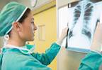 Osimertinib New Standard of Care for T790M+ Advanced NSCLC Osimertinib New Standard of Care for T790M+ Advanced NSCLC