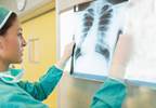 Chemotherapy Use Associated with Survival Benefit Among Medicare Patients with SCLC Chemotherapy Use Associated with Survival Benefit Among Medicare Patients with SCLC