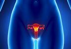 Pazopanib Plus Paclitaxel Does Not Improve Outcomes in Recurrent Ovarian Cancer Pazopanib Plus Paclitaxel Does Not Improve Outcomes in Recurrent Ovarian Cancer