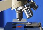 Improved survival in pediatric umbilical cord transplants for hematologic cancers Improved survival in pediatric umbilical cord transplants for hematologic cancers