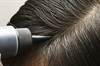Hair dye use during chemotherapy Hair dye use during chemotherapy