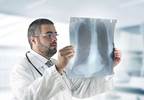 Increased 5-Year Survival Rate Seen in NSCLC Subset Treated With Nivolumab Increased 5-Year Survival Rate Seen in NSCLC Subset Treated With Nivolumab