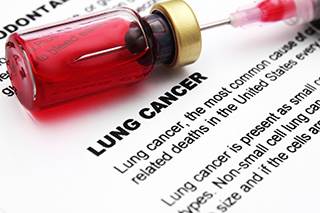 Updated guideline hopeful for patients with lung cancer Updated guideline hopeful for patients with lung cancer