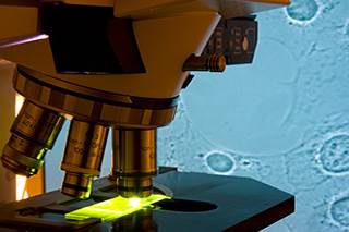 Finding biomarkers for early lung cancer diagnosis Finding biomarkers for early lung cancer diagnosis