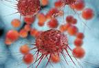 Ovarian Cancer Includes More Than One Kind of Malignancy Ovarian Cancer Includes More Than One Kind of Malignancy