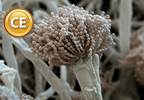 Managing Aspergillus infection in HSCT recipients Managing Aspergillus infection in HSCT recipients