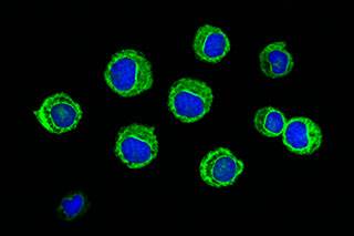New opportunity to treat drug-resistant leukemia discovered New opportunity to treat drug-resistant leukemia discovered