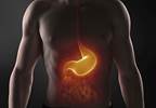No Benefit for Chemoradiotherapy vs Chemotherapy After Resectable Gastric Cancer No Benefit for Chemoradiotherapy vs Chemotherapy After Resectable Gastric Cancer