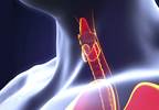 Transforming the Care of Patients With Thyroid Cancer Transforming the Care of Patients With Thyroid Cancer
