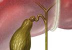 Bile duct cancer study may pave way for new treatments Bile duct cancer study may pave way for new treatments