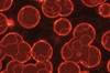 Navigating Patients With Hematologic Cancers Navigating Patients With Hematologic Cancers
