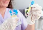 Blood Test Can Guide Treatment Sequencing for Pancreatic Cancer Blood Test Can Guide Treatment Sequencing for Pancreatic Cancer
