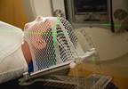 Palliative radiotherapy: An evolving centerpiece of supportive care Palliative radiotherapy: An evolving centerpiece of supportive care