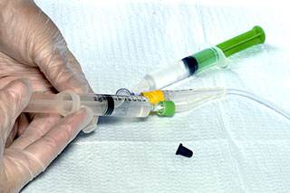 Innovations Reduce Catheter Associated Urinary Tract Infection Rates at an Oncology Hospital Innovations Reduce Catheter Associated Urinary Tract Infection Rates at an Oncology Hospital