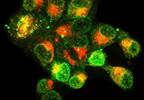 Internationally Applicable Prognostic Index for 5-Year OS Validated for Patients with CLL Internationally Applicable Prognostic Index for 5-Year OS Validated for Patients with CLL