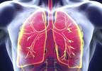 Ongoing Phase IIIb/IV Trial Shows Consistent Safety Data with Nivolumab in NSCLC Ongoing Phase IIIb/IV Trial Shows Consistent Safety Data with Nivolumab in NSCLC