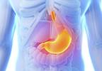 Pembrolizumab Active in Advanced Gastric Cancer Pembrolizumab Active in Advanced Gastric Cancer