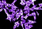 Survival Benefit in Advanced Melanoma With Pembrolizumab Versus Ipilimumab Survival Benefit in Advanced Melanoma With Pembrolizumab Versus Ipilimumab