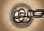 Ipilumumab Feasible for Recurrent Hematologic Cancers After Allogeneic Stem Cell Transplant Ipilumumab Feasible for Recurrent Hematologic Cancers After Allogeneic Stem Cell Transplant