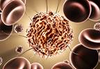 Research breakthrough identifies how mutated genes reprogram blood stem cells in leukemia Research breakthrough identifies how mutated genes reprogram blood stem cells in leukemia