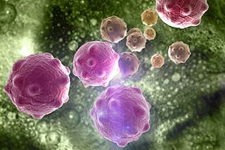 Auranofin, a drug used to treat arthritis, helped boost the effectiveness of RAPTA-T in attacking tumors. Auranofin, a drug used to treat arthritis, helped boost the effectiveness of RAPTA-T in attacking tumors.