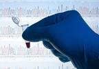 HER2 Peptide Vaccine Fails to Prevent Breast Cancer Recurrence HER2 Peptide Vaccine Fails to Prevent Breast Cancer Recurrence