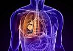 Include Visual Emphysema, COPD Exacerbations When Assessing for Lung Cancer Include Visual Emphysema, COPD Exacerbations When Assessing for Lung Cancer