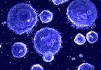 Cancer-induced Weakness in Immune System May Be Key to HER2+ Breast Cancer Recurrence, and Prevention Cancer-induced Weakness in Immune System May Be Key to HER2+ Breast Cancer Recurrence, and Prevention