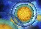 COG: Immunophenotypic Expression Profiles Can Help Predict Outcome in AML COG: Immunophenotypic Expression Profiles Can Help Predict Outcome in AML