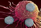 Use of Checkpoint Inhibitors in Urothelial Carcinoma Use of Checkpoint Inhibitors in Urothelial Carcinoma