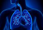 Aspiration Screening Reduces Aspiration Pneumonia Rates Among Hospitalized Patients Aspiration Screening Reduces Aspiration Pneumonia Rates Among Hospitalized Patients
