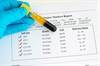 USPSTF Updates Guidelines for PSA-Based Screening for Prostate Cancer in Older Men USPSTF Updates Guidelines for PSA-Based Screening for Prostate Cancer in Older Men