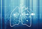 Modern Management of Malignant Pleural Mesothelioma Modern Management of Malignant Pleural Mesothelioma