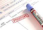 HIV Infection Worsens Survival of Patients With Cervical Cancer HIV Infection Worsens Survival of Patients With Cervical Cancer