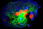 New Therapy Holds Potential for Neuroblastoma Treatment New Therapy Holds Potential for Neuroblastoma Treatment