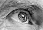 Biomarker for Class 1 Uveal Melanoma Correlates with Metastatic Disease Biomarker for Class 1 Uveal Melanoma Correlates with Metastatic Disease