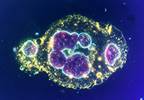 Alemtuzumab + CHOP for Peripheral T Cell Lymphoma: Higher Remission, But Not Survival Alemtuzumab + CHOP for Peripheral T Cell Lymphoma: Higher Remission, But Not Survival